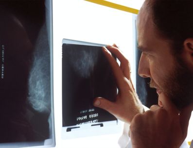 En Latinoamérica la detección de casos de cáncer de próstata se da una etapa muy tardía, por los mismos tabúes que existen. UNSPLASH/nci