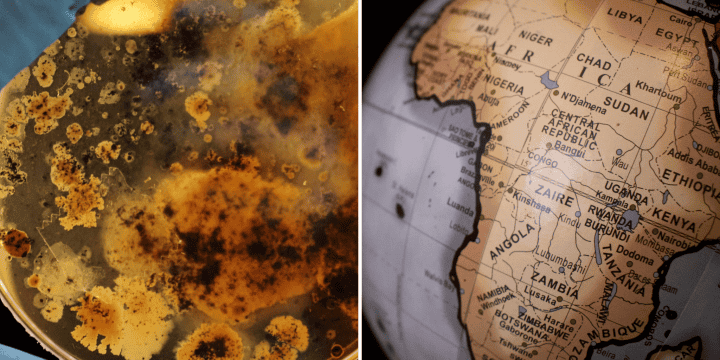 Este brote es de magnitudes sin precedentes, afectando a nueve de las diez provincias de Zambia por lo que la preocupación de una expansión más allá de su área geográfica es alta.  UNSPLASH/Adrian Lange/James Wiseman