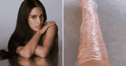 Kim Kardashian mostró las secuelas que le ha dejado la psoriasis en su cuerpo. Conoce todo sobre esta enfermedad. FACEBOOK/Kim Kardashian  | INSTAGRAM/@kimkardashian