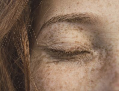 Las manchas en la piel pueden ser un indicio de problemas médicos por lo que ver al dermatólogo ante cualquier duda es de suma importancia. UNSPLASH/Chermiti Mohamed